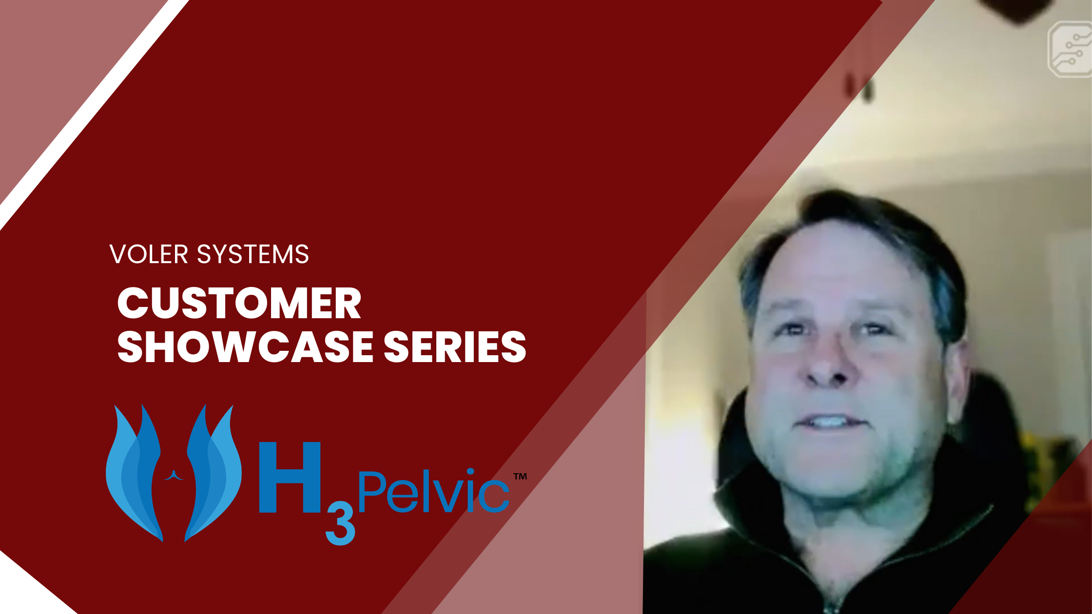 Customer Showcase Series - Episode 6: H3Pelvic